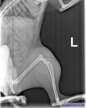 Röntgenbild des komplizierten Bruchs